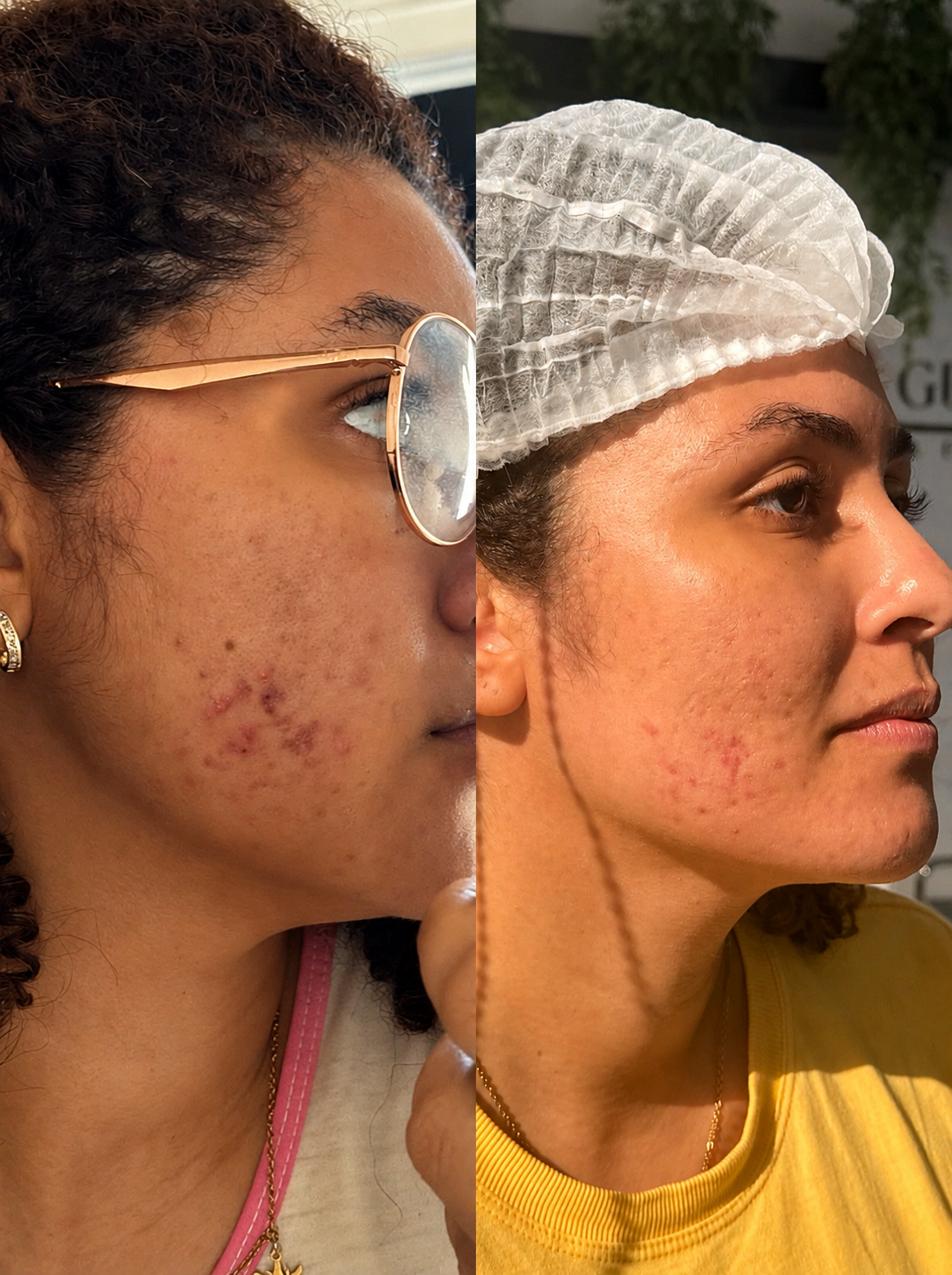 Resultado de atendimento BeautyFace