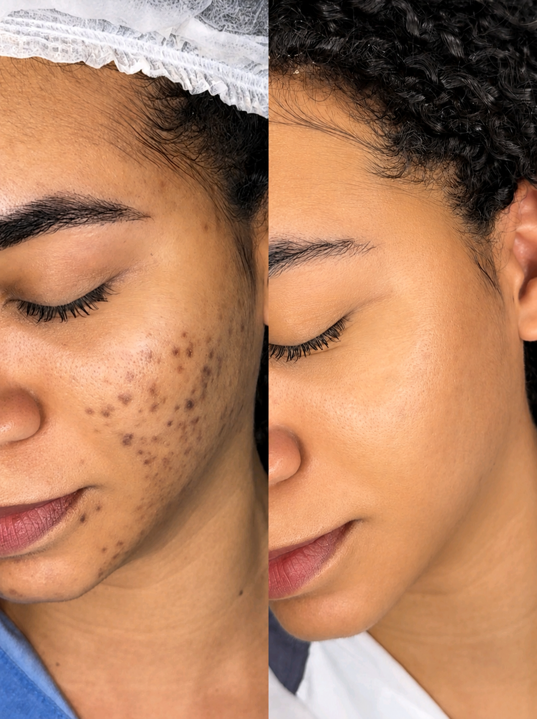 Resultado de atendimento BeautyFace