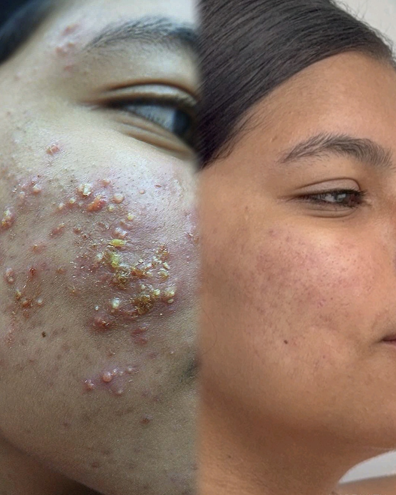 Resultado de atendimento BeautyFace